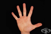 �� ���������� ����� �� �� ��������...